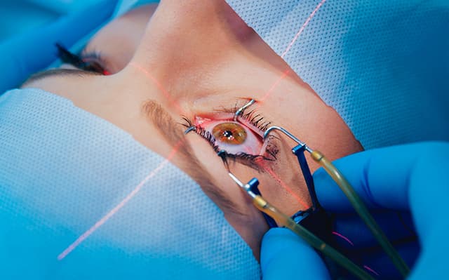 Cirugía refractiva láser (LASIK / PRK)
